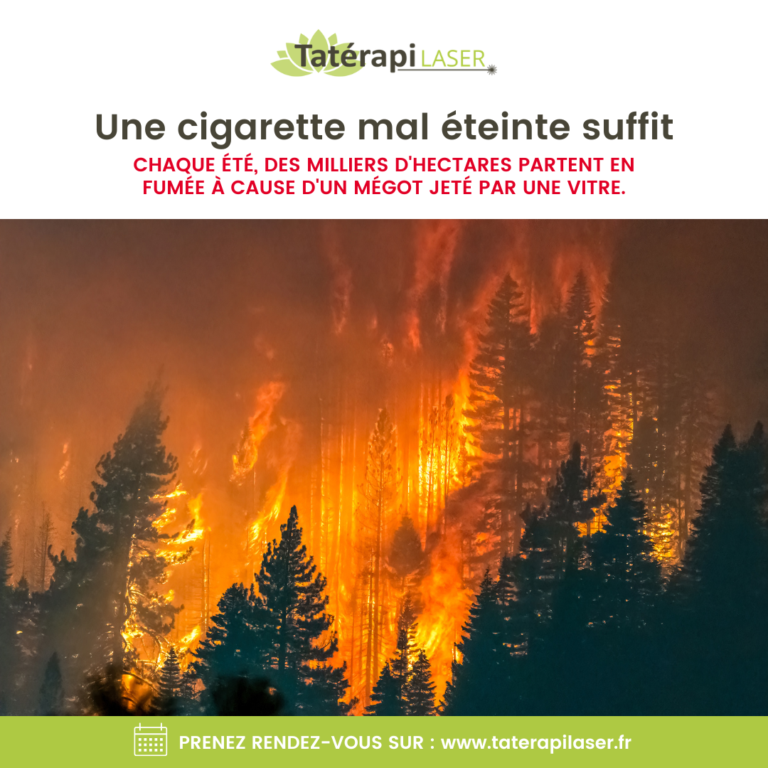 Tatérapi Laser Dommartin-lès-Toul